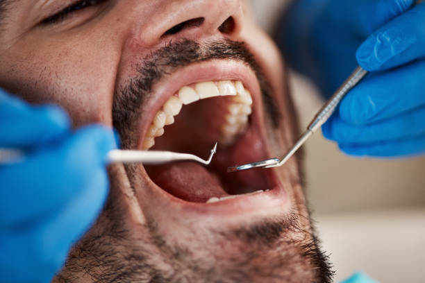 Best Emergency Cosmetic Dentistry (e.g., broken veneers) in Nephi, UT