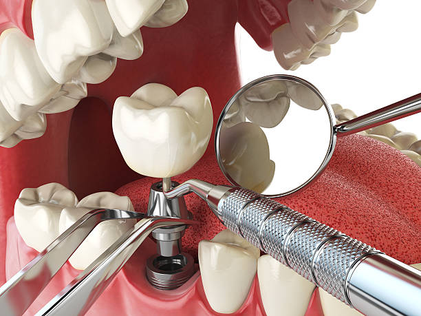 Best Emergency Denture Repair in Nephi, UT